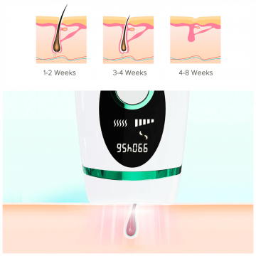 Xiaomi Epilator IPL, lasersko uklanjanje dlačica 900.000 bljeskova - Inface IPL Hair Remover White/Green